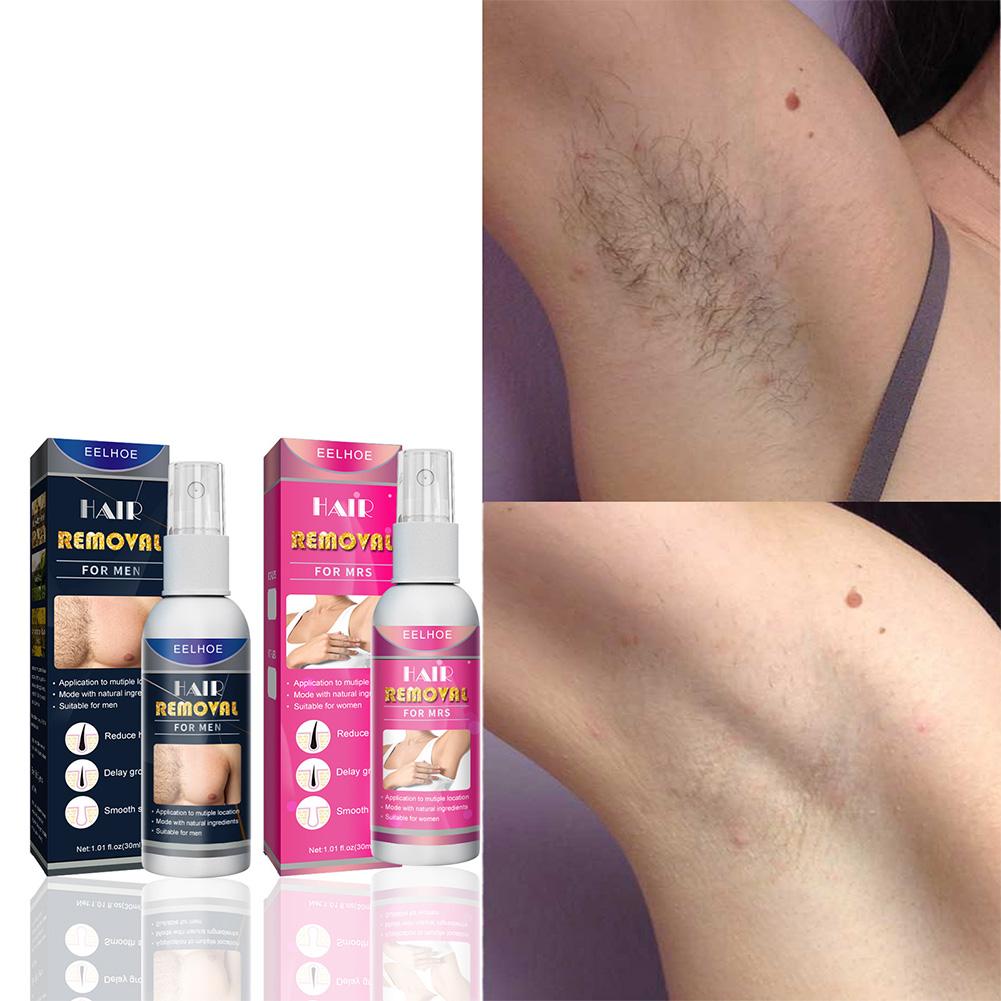 Épilateur Permanent indolore S - Hair Care Women avis et prix
